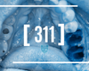 (311) PRESERVE THIS: INTRODUCTION TO EXTRACTION, SOCKET PRESERVATION AND PRP COURSE