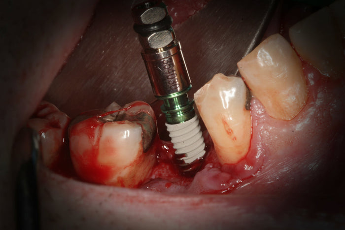 Finding Your Next Step: Why Hands-On Surgical Training Changes Everything in Practice