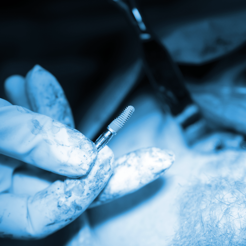 FULL-ARCH DIGITAL IMPLANT WORKFLOW