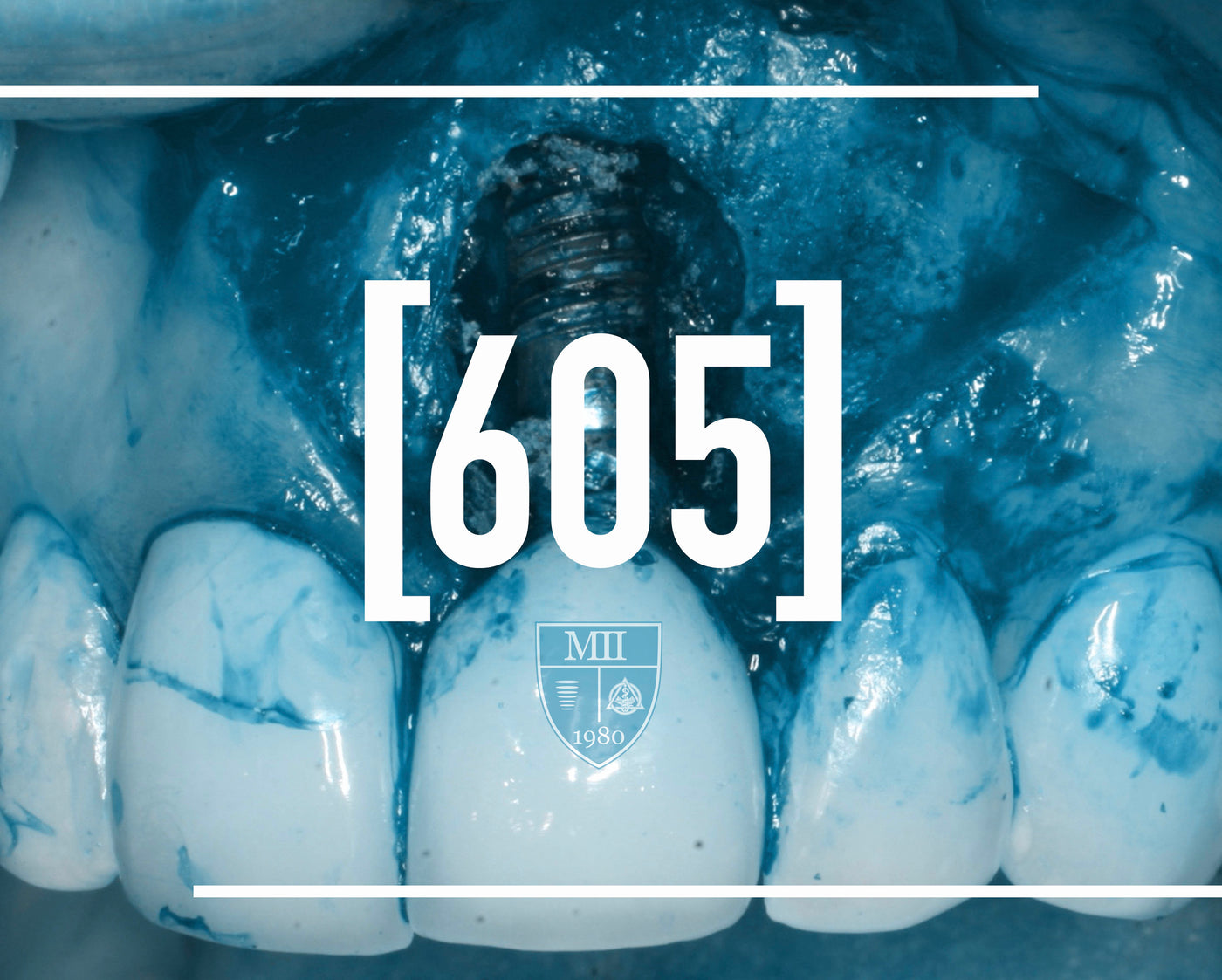 [605] The digging out of problems course.