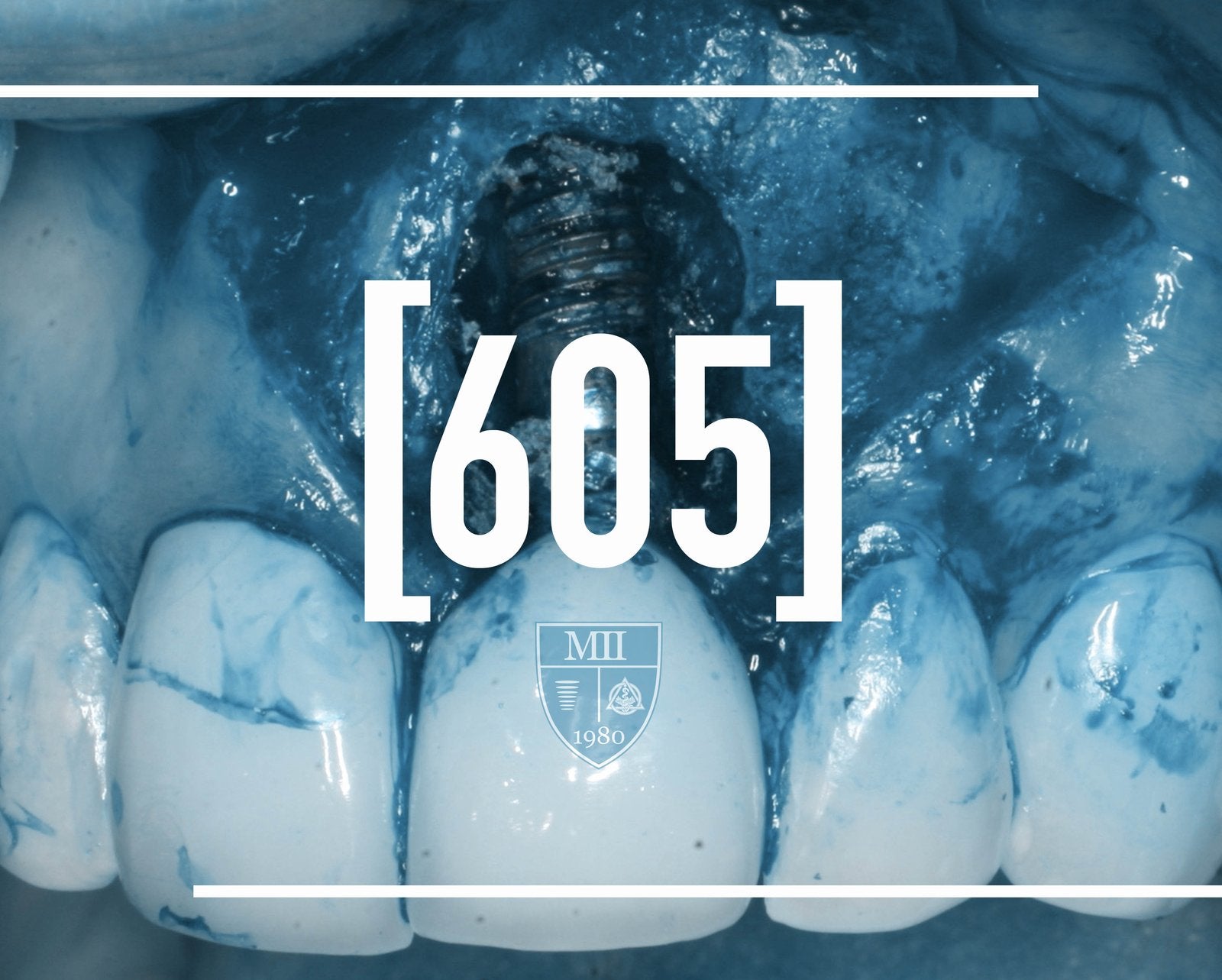 (605) THE DIGGING OUT OF PROBLEMS COURSE, 145 GREEN MEADOWS DRIVE SOUTH, LEWIS CENTER OHIO, 43035